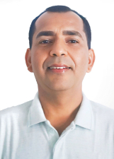Foto oficial de Albervan Nunes